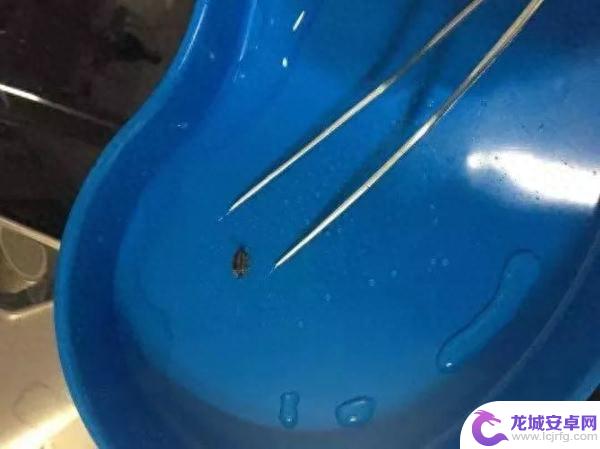 崩溃！半夜玩手机耳朵突然……医生：曾取出过一串